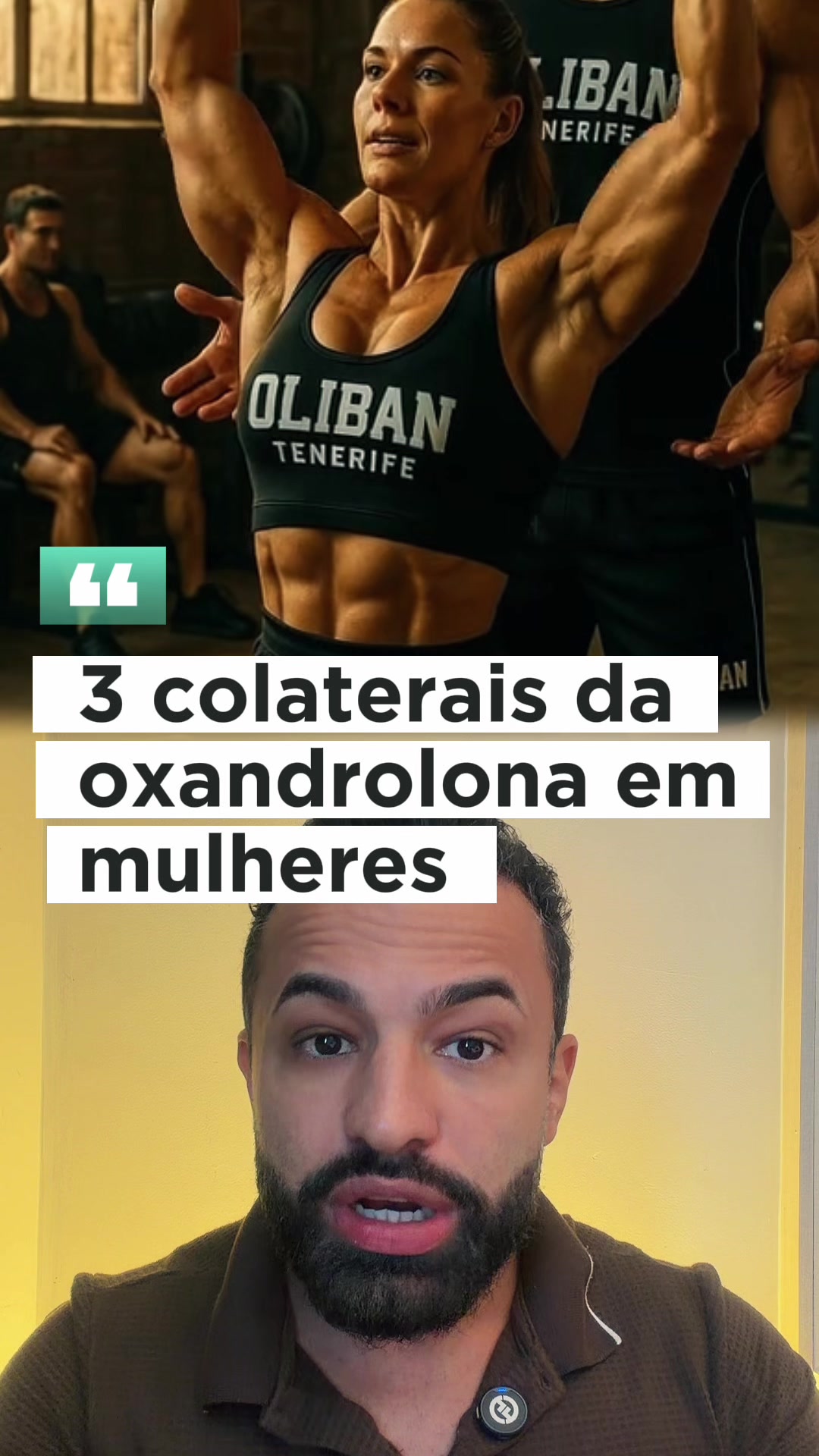 dr.marcelo.santos - Video 36