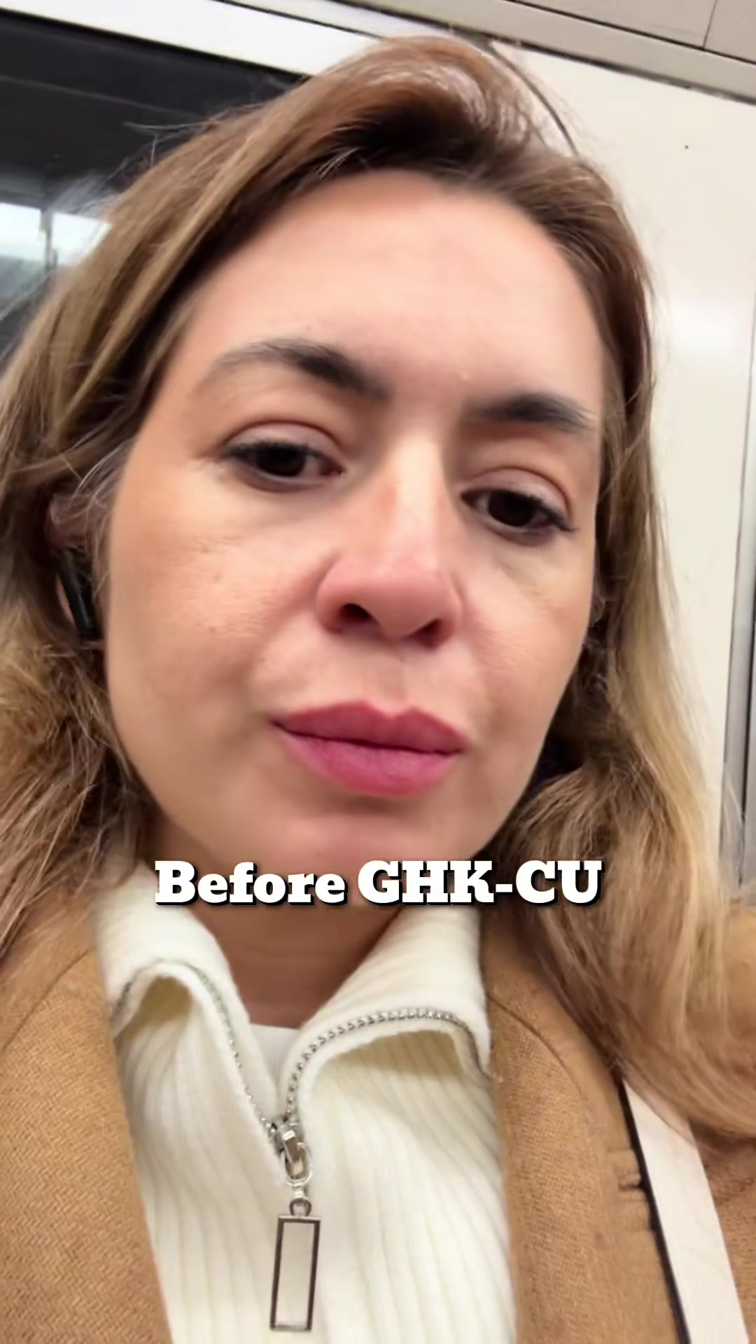 Resultado com uso do Glow GHK-Cu .  #ghk #fyy #glow #skincaretips #fo...