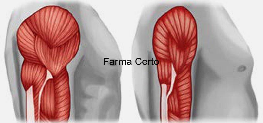 sarcopenia